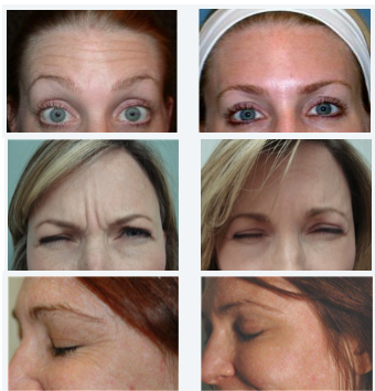 Minster Dental Care | Preventative Program, Digital Radiography and Dermal Fillers