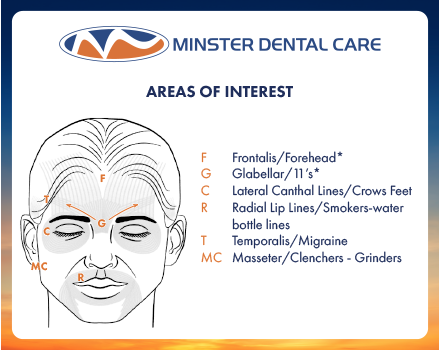Minster Dental Care | Sleep Apnea, Soft Tissue Laser and Implant Restorations