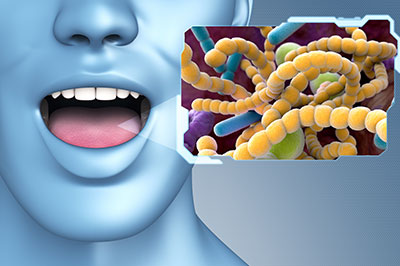 Minster Dental Care | Dental Cleanings, Pediatric Extractions and Ceramic Crowns