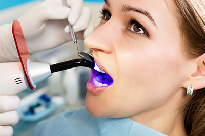 Minster Dental Care | Intraoral Camera, Same Day Crowns and Pediatric Fillings