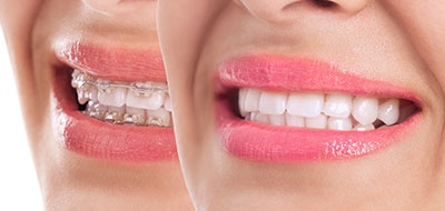Minster Dental Care | Ceramic Crowns, Digital Radiography and Pediatric Dentistry