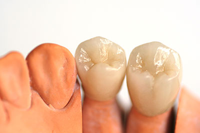 Minster Dental Care | Oral Cancer Screening, Full Mouth Reconstruction and Cosmetic Dentistry