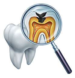 Minster Dental Care | CEREC, Implant Dentistry and Dental Cleanings
