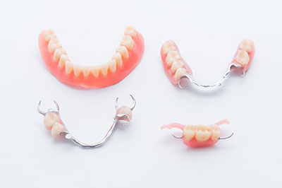 Minster Dental Care | Full Mouth Reconstruction, Cosmetic Dentistry and Pediatric Extractions