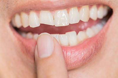 Minster Dental Care | Extractions, CBCT and Full Mouth Reconstruction