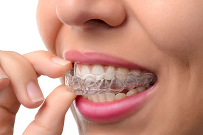 Minster Dental Care | Botox reg , Dental Fillings and CBCT