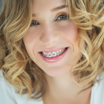 Minster Dental Care | Dental Fillings, Dermal Fillers and Pediatric Fillings