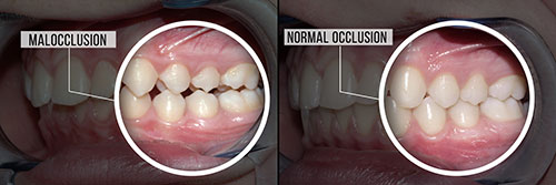 Minster Dental Care | Cosmetic Dentistry, Pediatric Dentistry and Snoring Appliances