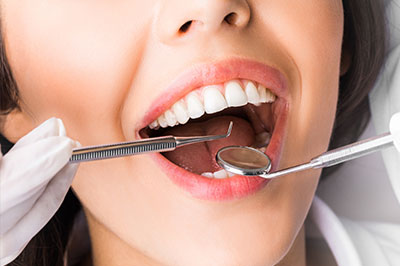 Minster Dental Care | Full Mouth Reconstruction, Dermal Fillers and Extractions