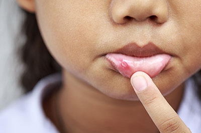 Minster Dental Care | Cosmetic Dentistry, Digital Impressions and Nitrous Oxide Sedation