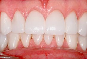 Minster Dental Care | Oral Cancer Screening, Extractions and Root Canals