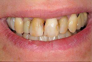 Minster Dental Care | Snoring Appliances, Intraoral Camera and Pediatric Dentistry